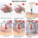Suction Massager Pain Relief 32 Cups Vacuum Cupping Set Massage Acupuncture Kit