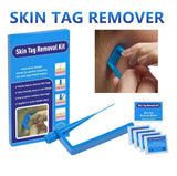 Skin Tag Remover Kit for Fast & Effective Skin Tag Removal