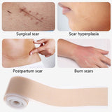 Silicone Gel Tape Scar Removal Self-Adhesive Efficient Removal Patch Tapes 50cm