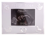 Picture Frame Baby Scan Ultrasound Sonogram Ultrasonography Pregnancy