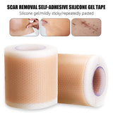 Silicone Gel Tape Scar Removal Self-Adhesive Efficient Removal Patch Tapes 50cm
