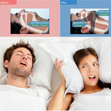 Stop Snoring Chin Strap Anti Snore Sleep Apnea Belt Apnoea Stopper Solution Jaw